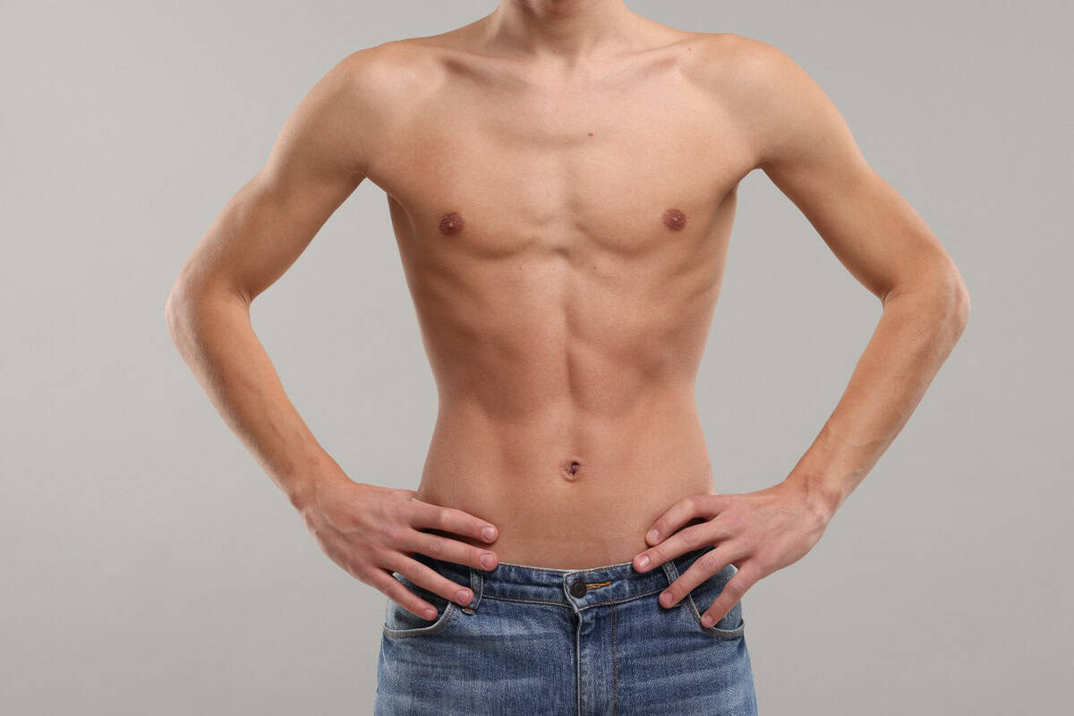 gynecomastia male body proportions