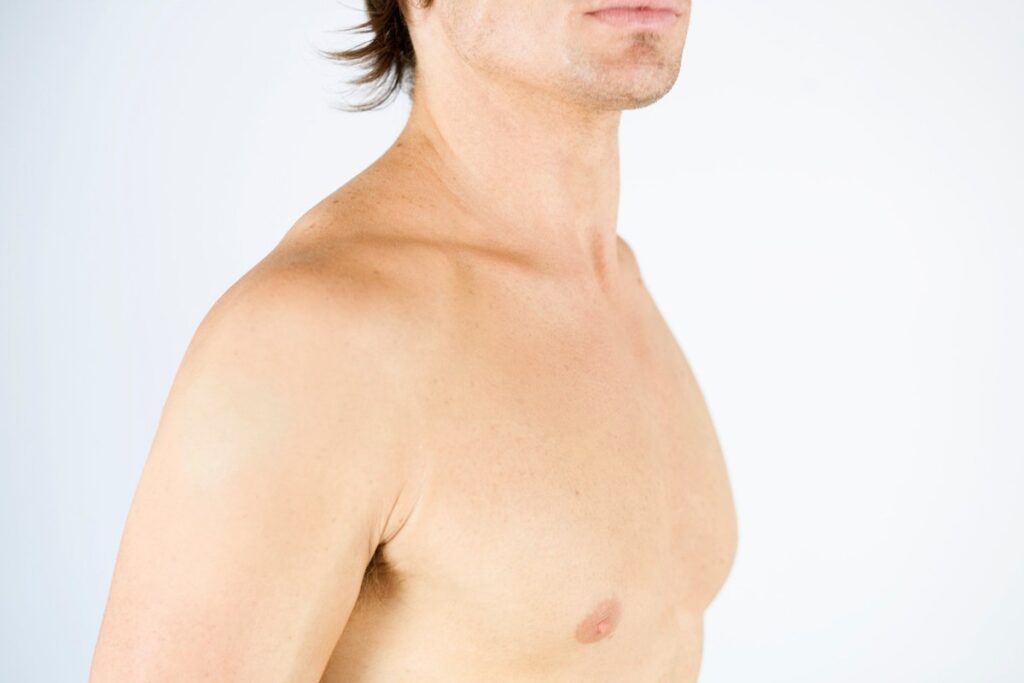 gynecomastia male chest profile shoulder view